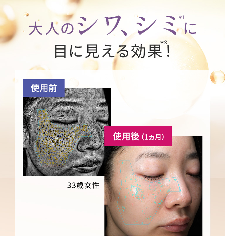 大人のシワ、シミに目に見える効果！