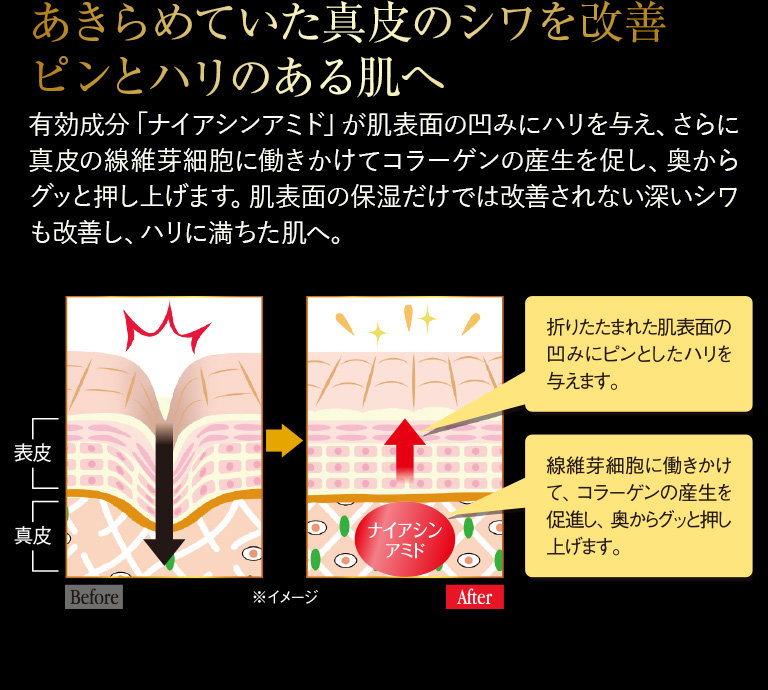 あきらめていた真皮のシワを改善ピンとハリのある肌へ