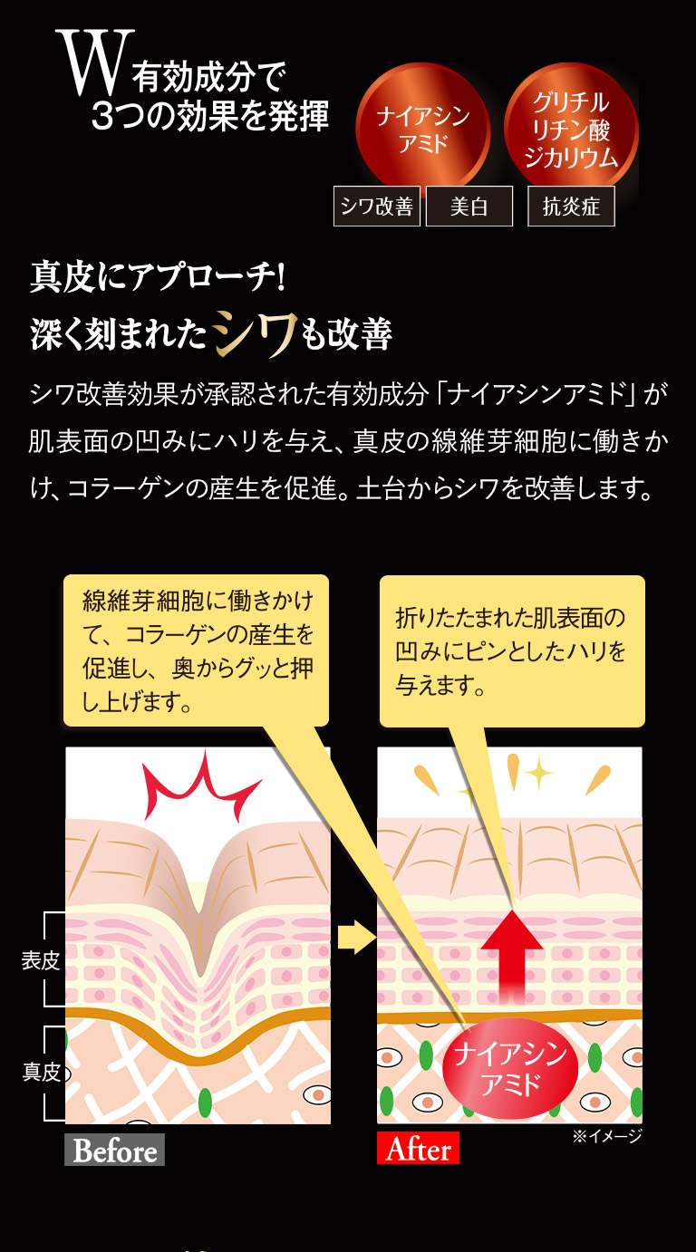 シワを狙い撃ち！若々しく凛としたまなざしへ